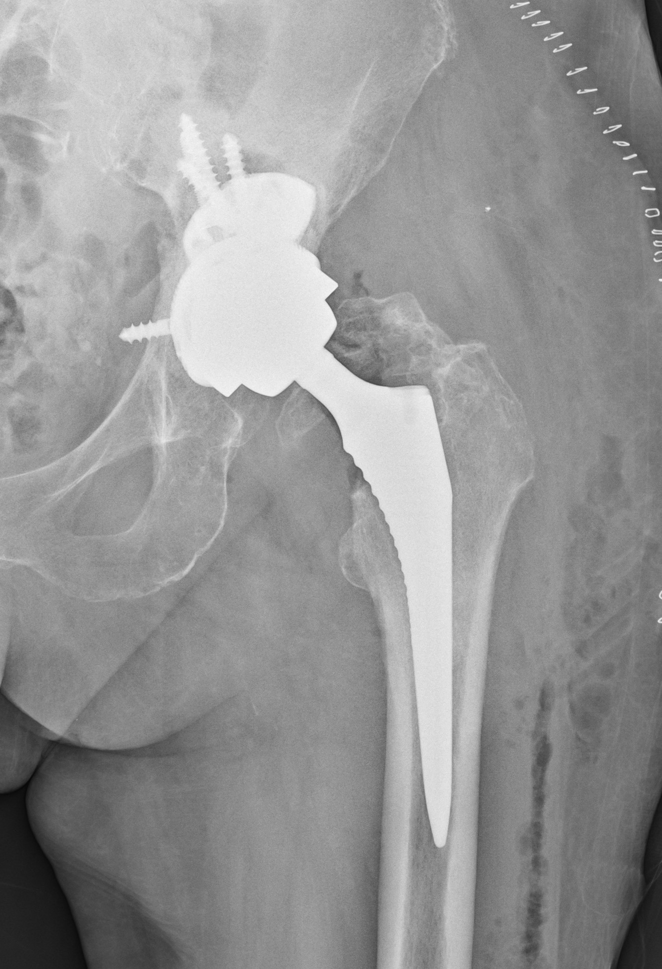 Snímok po operácii