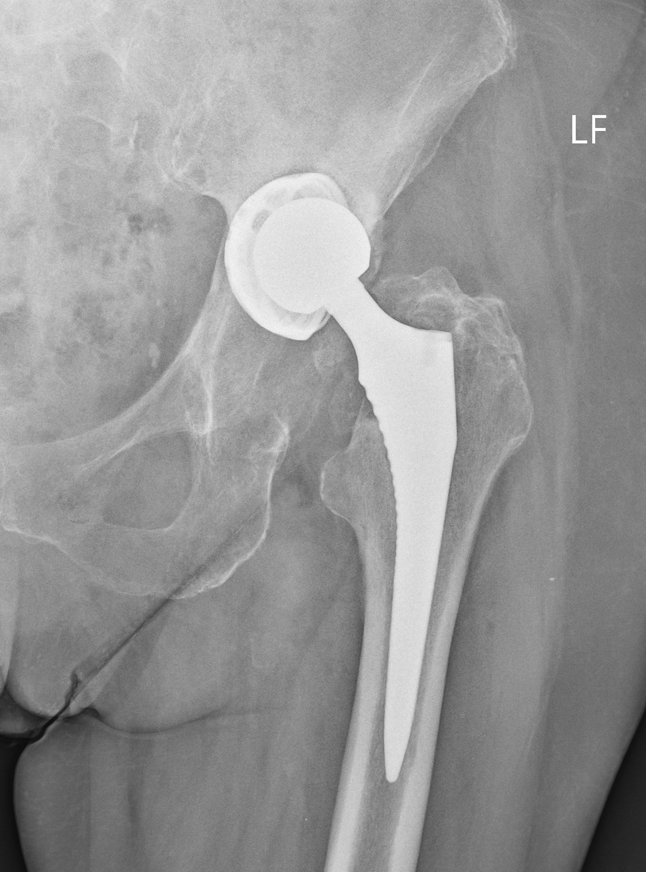 Snímok pred operáciou